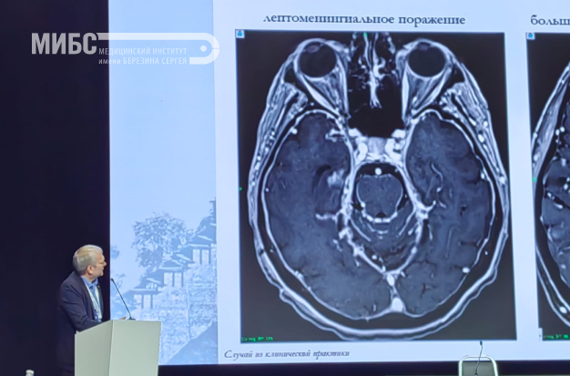 МИБС на XX WORLD CONGRESS OF STEREOTACTIC AND FUNCTIONAL NEUROSURGERY